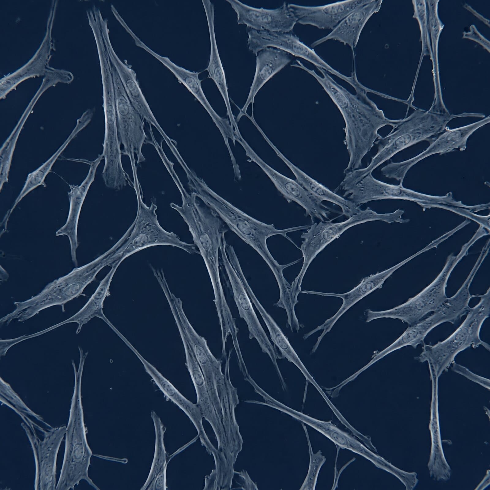 Spindle-shaped stem cells growing in culture, pale blue on navy